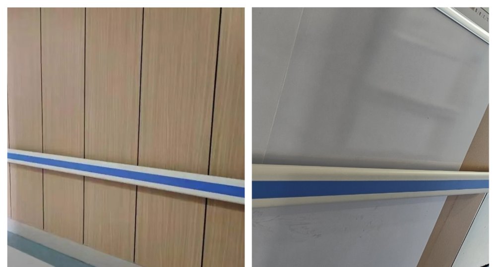 Hospital Handrail Project — Oman