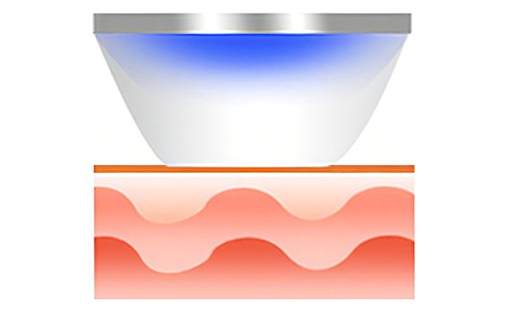 El cartucho de microagujas hace un contacto perfecto con la piel.