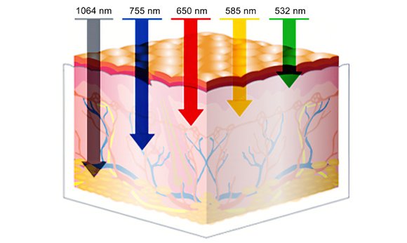 Longitudes de onda para el tratamiento de estructuras a diferentes profundidades de la piel