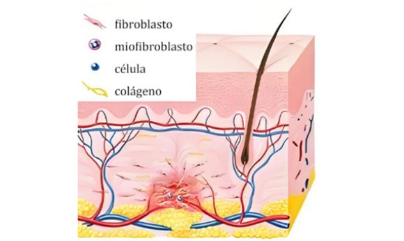 Periodo de solidificación de 0 a 48 horas