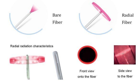 Endolift Micro optical fibers are available in two kinds: bare and radial