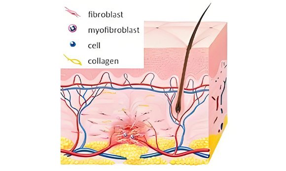 Solidifcation period 0 to 48 hours